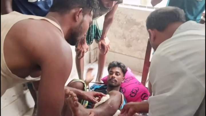 রায়পুরায় নিজের কাছে থাকা বন্দুকের গুলি বের হয়ে যুবক আহত