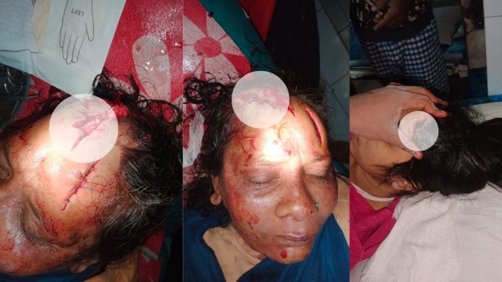 বেলকুচিতে প্রবাসীর বাড়িতে ডাকাতি, ৪ জন আহত