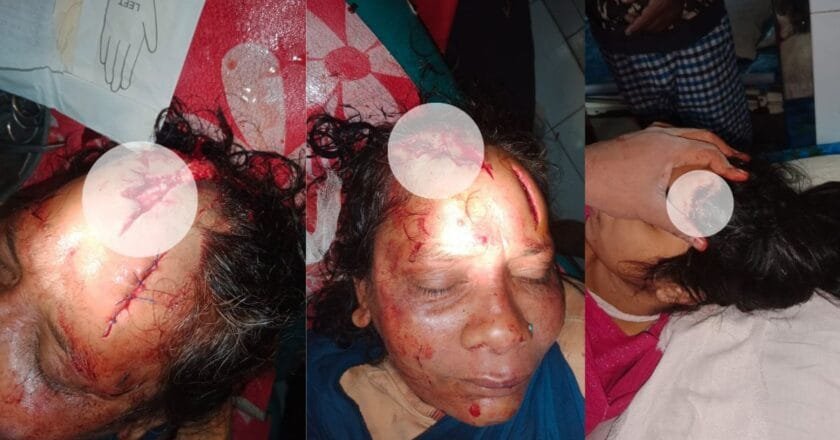 বেলকুচিতে প্রবাসীর বাড়িতে ডাকাতি, ৪ জন আহত