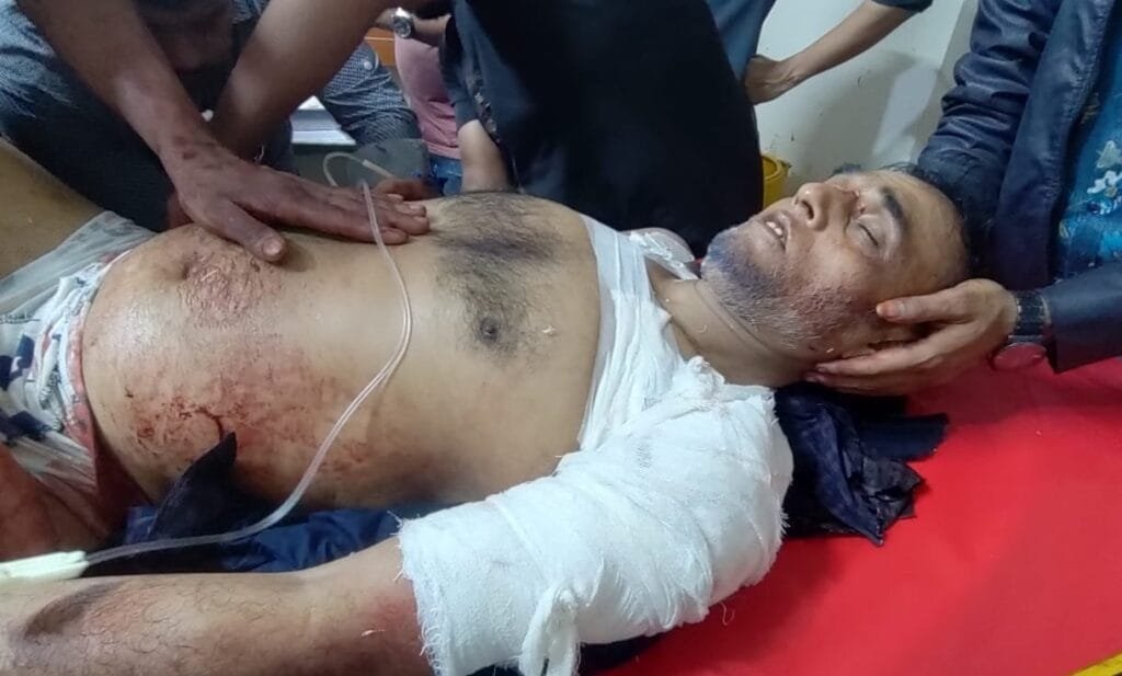 তজুমদ্দিনে মহিলা মেম্বারের স্বামীকে কুপিয়ে জখম, বাজার ব্যবসায়ীদের মানববন্ধন