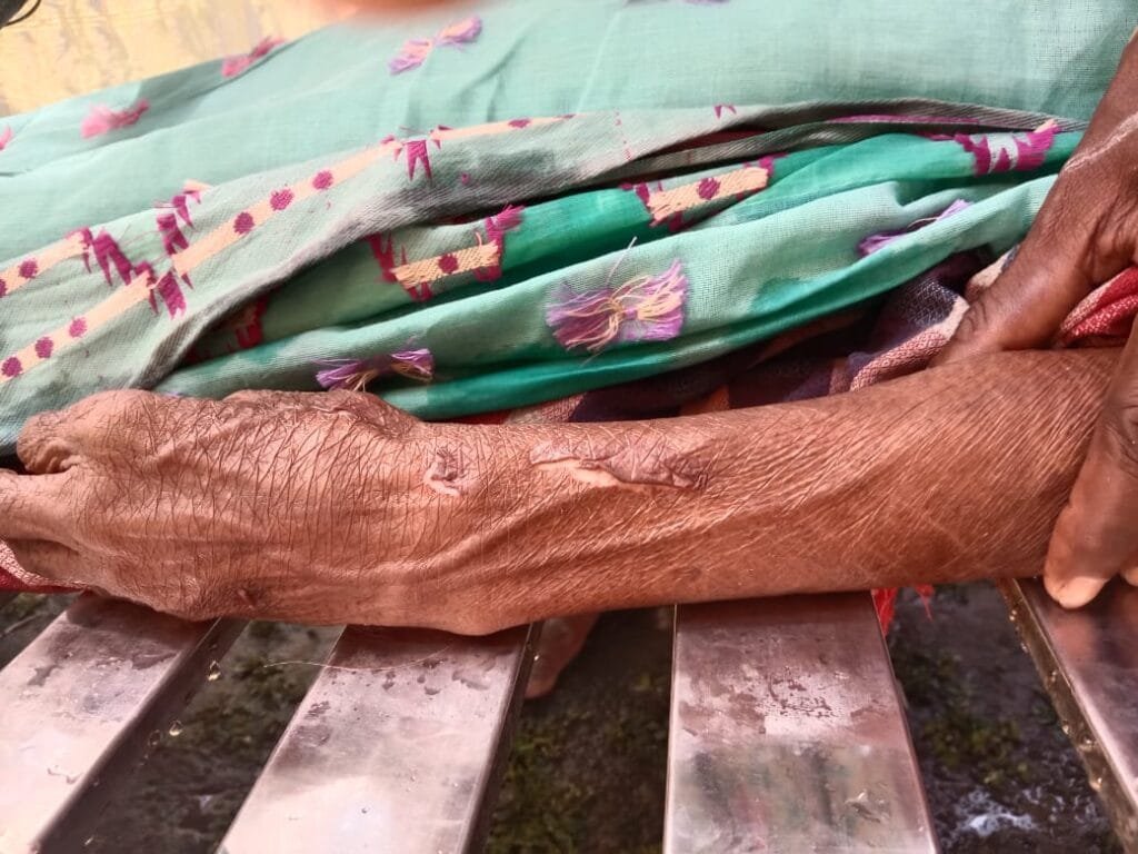 নাগেশ্বরীতে ট্রাক চাপায় প্রাণ গেল বৃদ্ধার