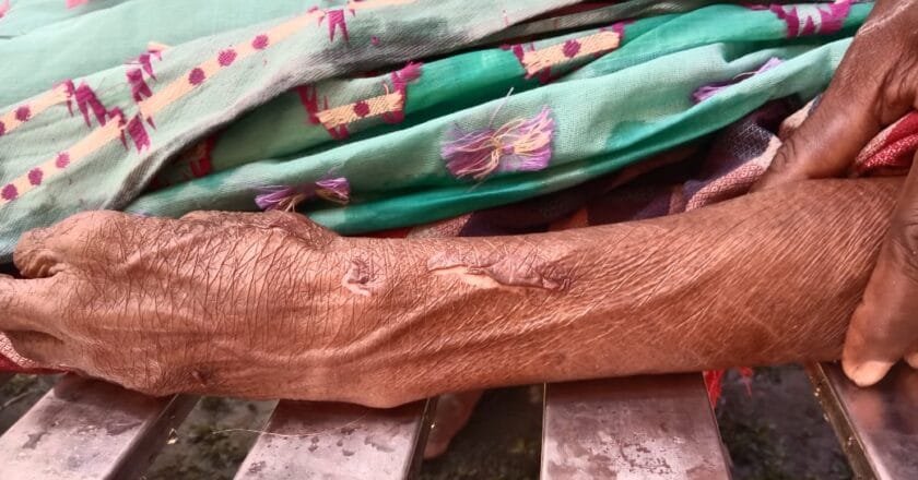 নাগেশ্বরীতে ট্রাক চাপায় প্রাণ গেল বৃদ্ধার