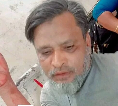 অজ্ঞাত দুষ্কৃতকারীর ধারালো অস্ত্রের আঘাতে ০১ জন গুরুতর আহত