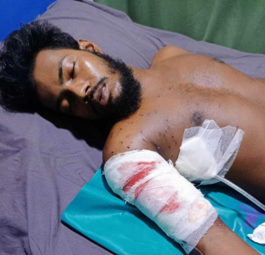 "দেহে ২৭৬ টি গুলি": চিকিৎসা না পাওয়া জুলাই যোদ্ধার করুন আর্তনাদ
