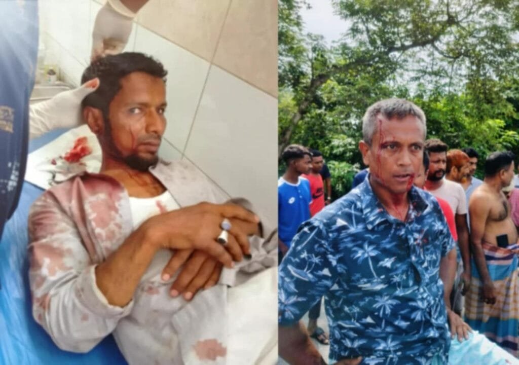 বেলকুচিতে সরকারি পুকুরে মাছ ধরা নিয়ে সংঘর্ষ, নারীসহ আহত ৯