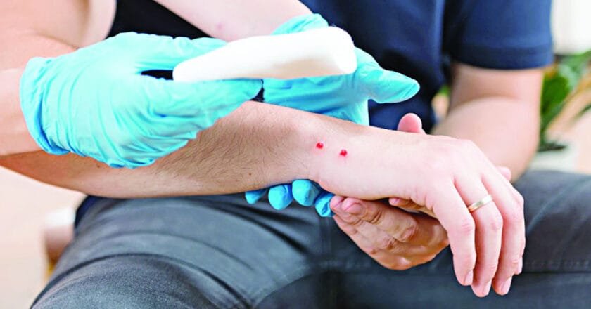 দেশে অ্যান্টিভেনমের ঘাটতি; সাপের কামড়ে বাড়ছে প্রাণহানি