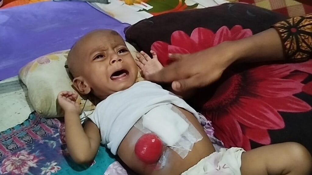 মানবতার স্পর্শে গড়ে উঠুক নতুন গল্প—বেঁচে যাক শিশু ফরহাদ