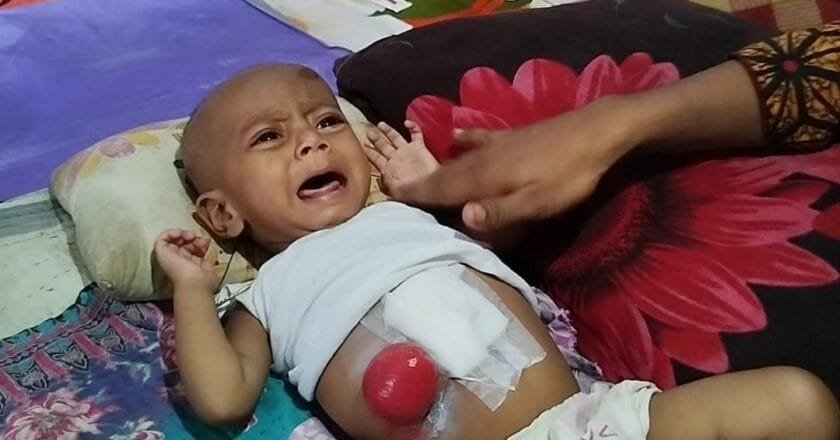 মানবতার স্পর্শে গড়ে উঠুক নতুন গল্প—বেঁচে যাক শিশু ফরহাদ