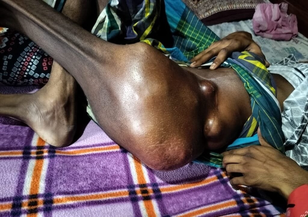 ক্যান্সারে আক্রান্ত বাবুলের জীবন বাঁচাতে সাহায্যের হাত বাড়ানোর আহ্বান