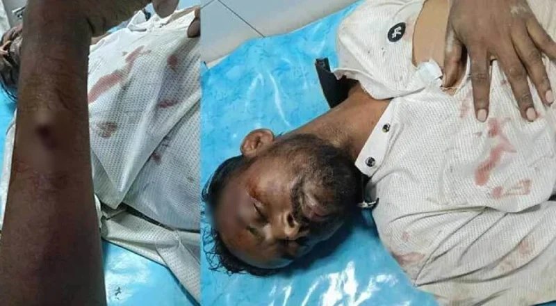 হামলার শিকার হিরো আলম; অবস্থা আশঙ্কাজনক