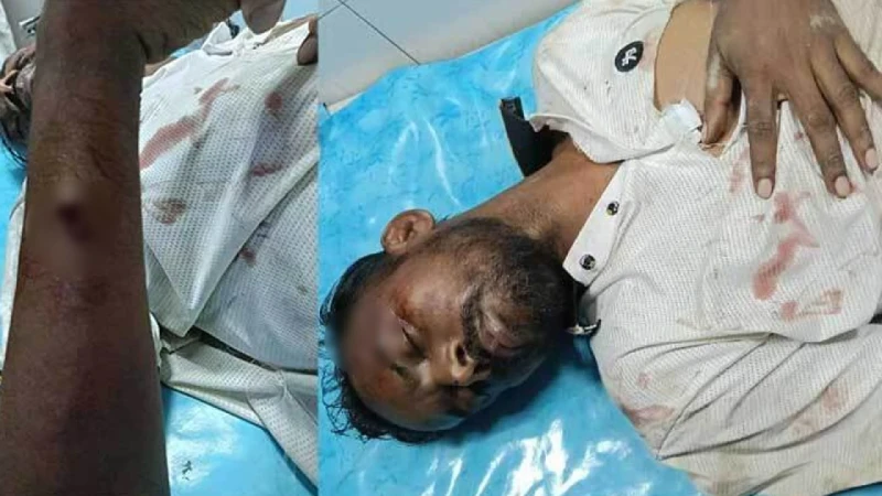 হামলার শিকার হিরো আলম; অবস্থা আশঙ্কাজনক
