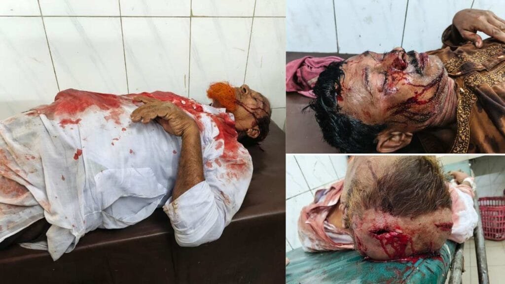 নাগেশ্বরীতে বিএনপির মনোনয়ন প্রত্যাশী দুই পক্ষের রক্তক্ষয়ী সংঘর্ষে আহত ৫