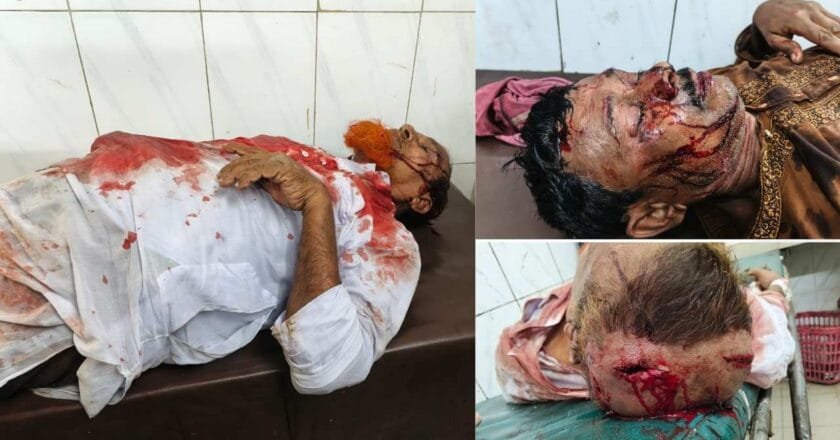 নাগেশ্বরীতে বিএনপির মনোনয়ন প্রত্যাশী দুই পক্ষের রক্তক্ষয়ী সংঘর্ষে আহত ৫