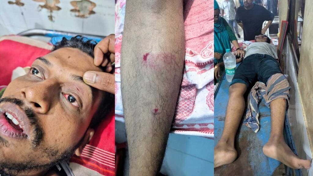 ফিক্সড-মিল নির্ধারণ নিয়ে ইবি শিক্ষার্থীদের মারামারি; আহত ৪