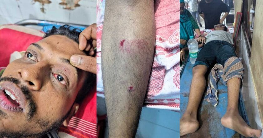 ফিক্সড-মিল নির্ধারণ নিয়ে ইবি শিক্ষার্থীদের মারামারি; আহত ৪