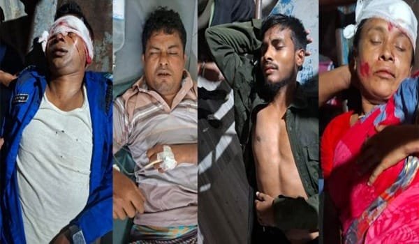 খুলনার রূপসায় প্রতিমা বিসর্জনকারীদের মিছিলে বাসের ধাক্কা, এএসআইসহ ৫ জন আহত
