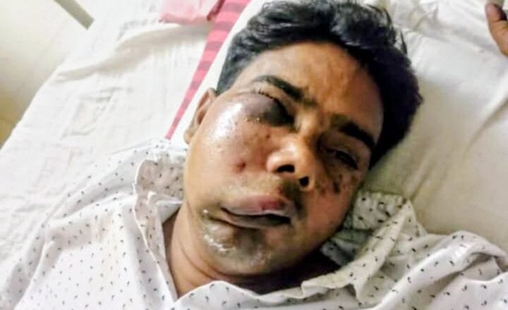 মানিকগঞ্জে বিএনপি’র দুই গ্রুপের সংঘর্ষ, আহত ১