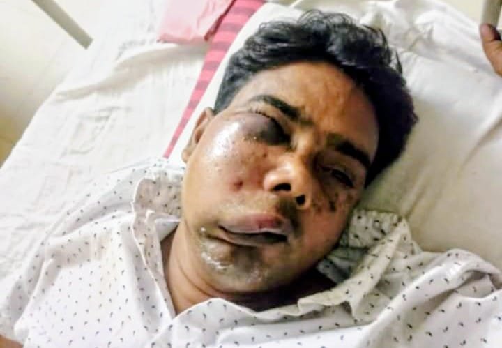 মানিকগঞ্জে বিএনপি'র দুই গ্রুপের সংঘর্ষ, আহত ১