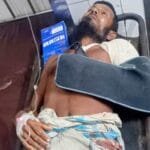 ডুমুরিয়ায় ছোট ভাইয়ের দা’র কোপে বড় ভাই গুরুতর জখম