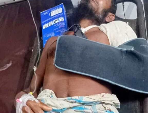 ডুমুরিয়ায় ছোট ভাইয়ের দা’র কোপে বড় ভাই গুরুতর জখম