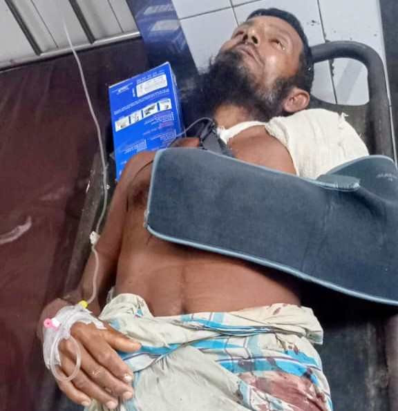 ডুমুরিয়ায় ছোট ভাইয়ের দা’র কোপে বড় ভাই গুরুতর জখম