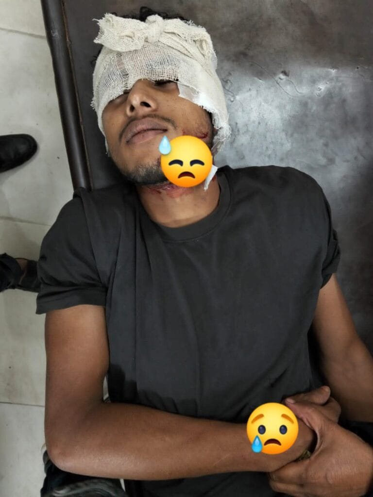 ঝিকরগাছায় সড়ক দুর্ঘটনায় আহত এক মোটরসাইকেল আরোহী