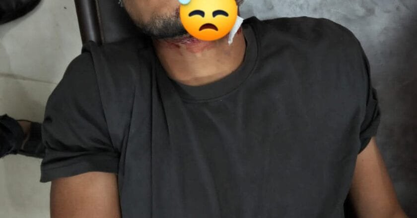 ঝিকরগাছায় সড়ক দুর্ঘটনায় এক মোটরসাইকেল আরোহী আহত