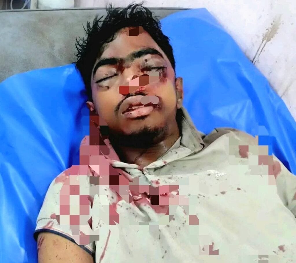 বেলকুচিতে সড়ক দুর্ঘটনায় মোটরসাইকেল আরোহী গুরুতর আহত