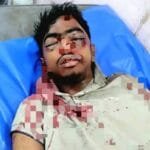 বেলকুচিতে সড়ক দুর্ঘটনায় মোটরসাইকেল আরোহী গুরুতর আহত