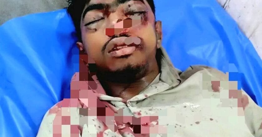 বেলকুচিতে সড়ক দুর্ঘটনায় মোটরসাইকেল আরোহী গুরুতর আহত