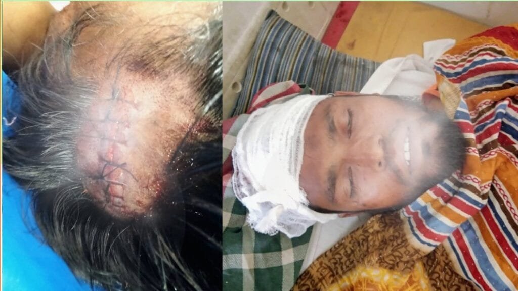 বেলকুচিতে বিএনপি কর্মীদের হামলায় জামায়াত নেতা আহত, নেতৃবৃন্দের নিন্দা