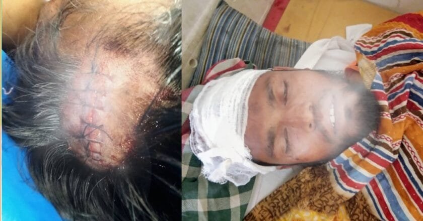বেলকুচিতে বিএনপি কর্মীদের হামলায় জামায়াত নেতা আহত, নেতৃবৃন্দের নিন্দা