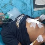 খুলনায় গুলির পর ঢাকার পথে অ্যাম্বুলেন্সে হামলা