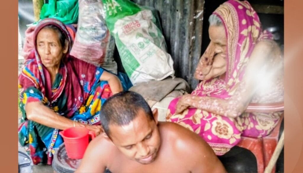 মুমূর্ষু মা ও প্রতিবন্ধী ছেলেকে নিয়ে আম্বিয়ার বিদ্যুতবিহীন মানবেতর জীবন: বাঁচার আকুতি