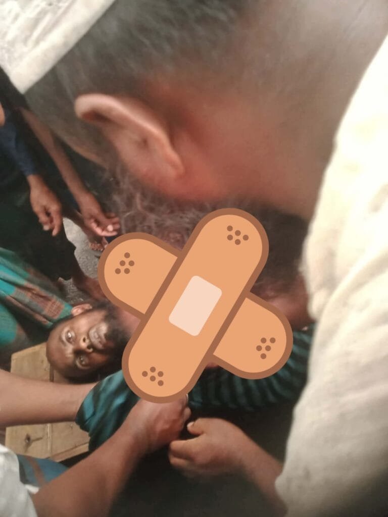 বকশীগঞ্জে বজ্রপাতে বাবা-ছেলে আহত, একজনের অবস্থা গুরুতর