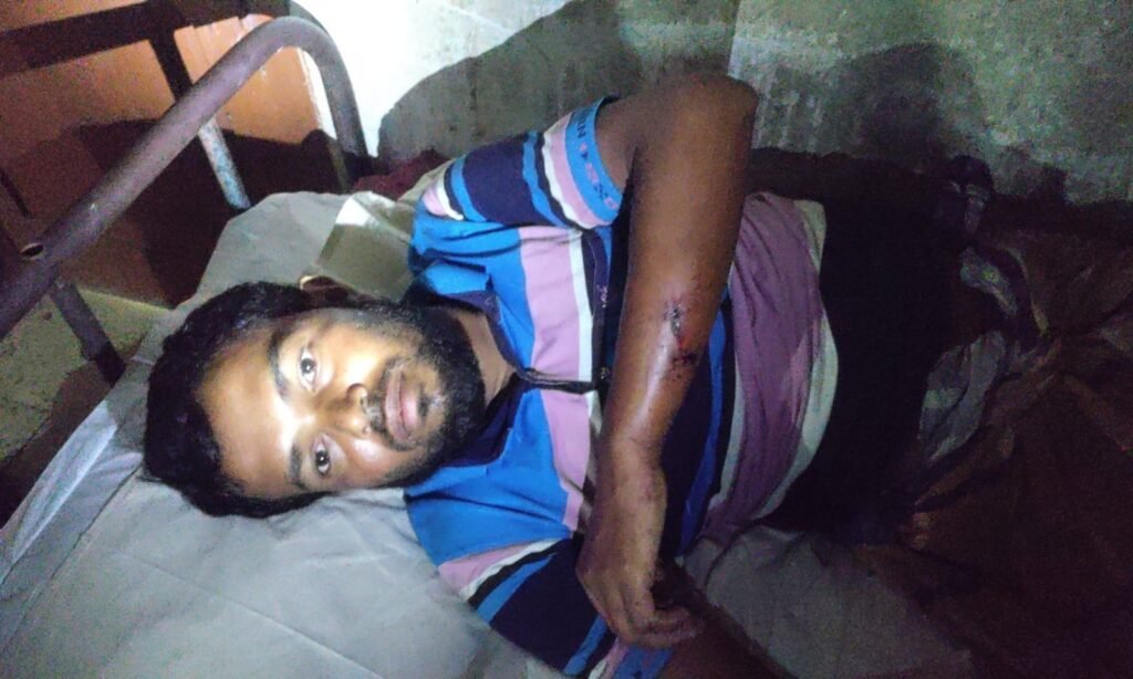 তজুমদ্দিনে মহিষের বাছুরের ঘাস খাওয়াকে কেন্দ্র করে মারামারি, আহত ১