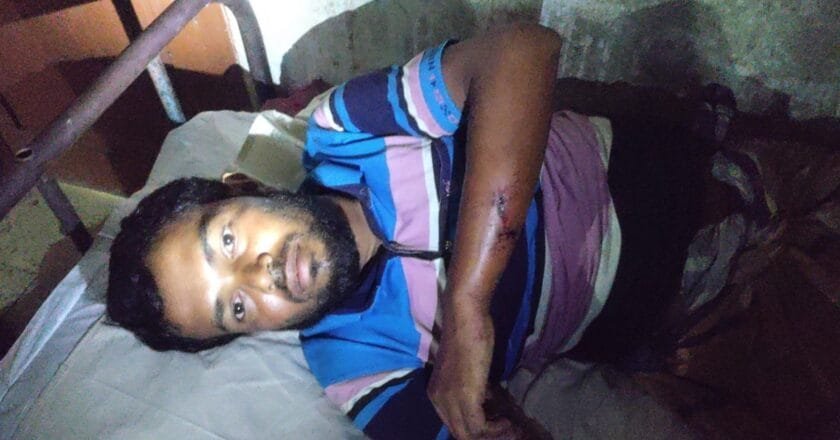 তজুমদ্দিনে মহিষের বাছুরের ঘাস খাওয়াকে কেন্দ্র করে মারামারি, আহত ১