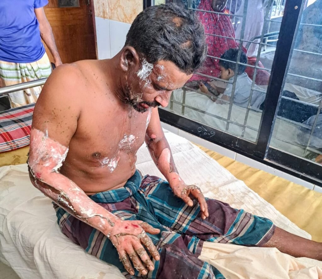 বদলগাছীতে পেট্রোল ঢেলে শ্রমিক সর্দারকে পুড়িয়ে দেওয়ার অভিযোগ, আটক ১
