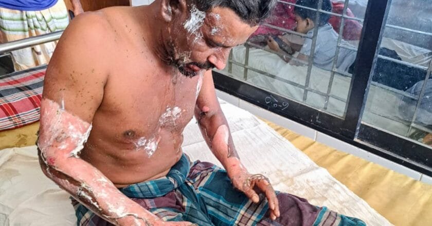 বদলগাছীতে পেট্রোল ঢেলে শ্রমিক সর্দারকে পুড়িয়ে দেওয়ার অভিযোগ, আটক ১