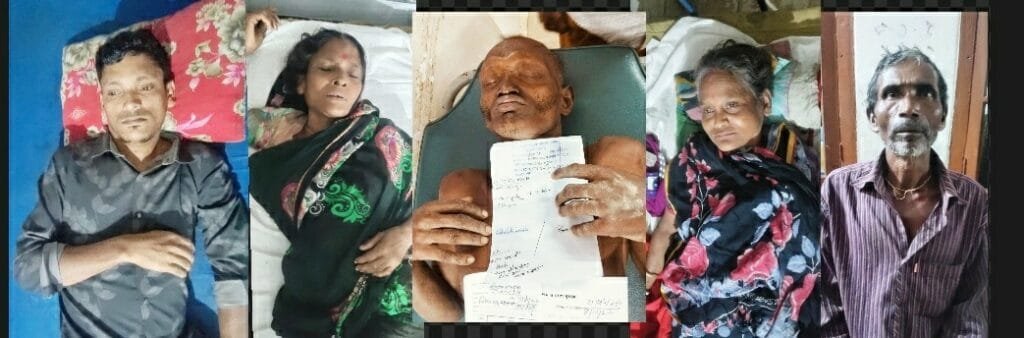 তজুমদ্দিনে চলাচলের পথে সুপারি চারা রোপণ নিয়ে সংঘর্ষ, প্রতিবন্ধীসহ আহত ৫