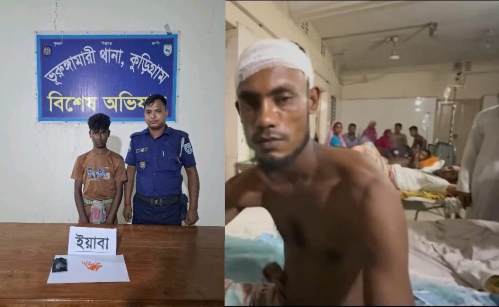 পুলিশের হাত থেকে বাঁচতে কামড়, হাসপাতালে গিয়ে ধরা ইয়াবাকারবারি