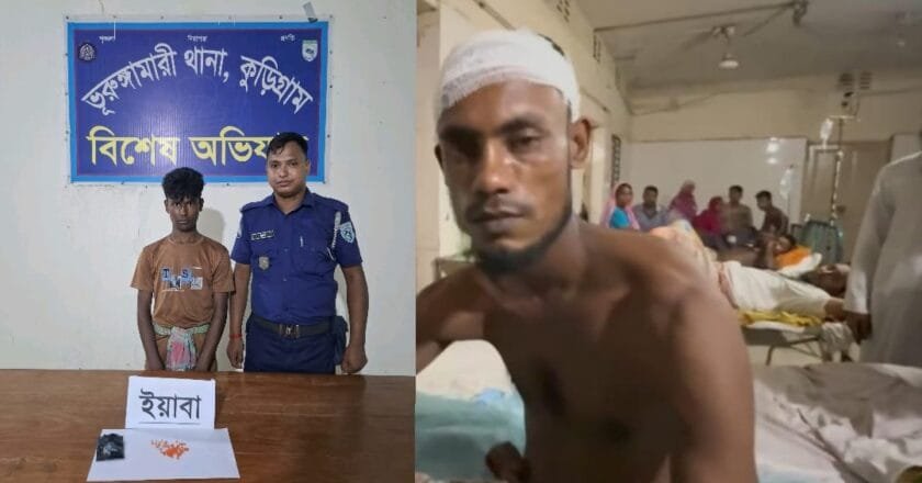 পুলিশের হাত থেকে বাঁচতে কামড়, হাসপাতালে গিয়ে ধরা ইয়াবাকারবারি
